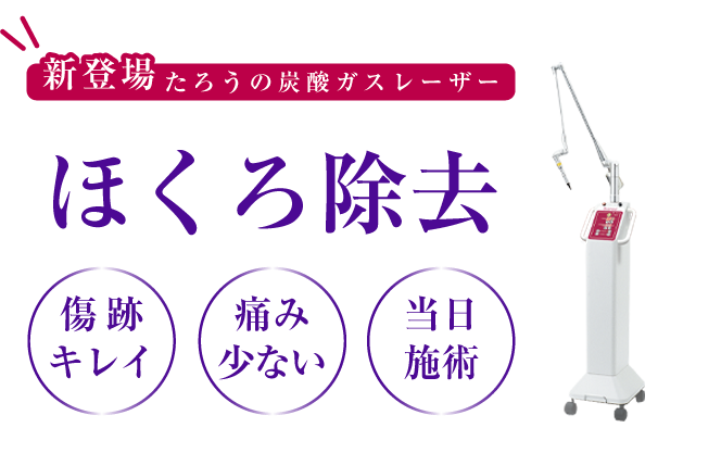 新登場炭酸ガスレーザー　ほくろ除去、傷跡キレイ、痛み少ない、当日施術