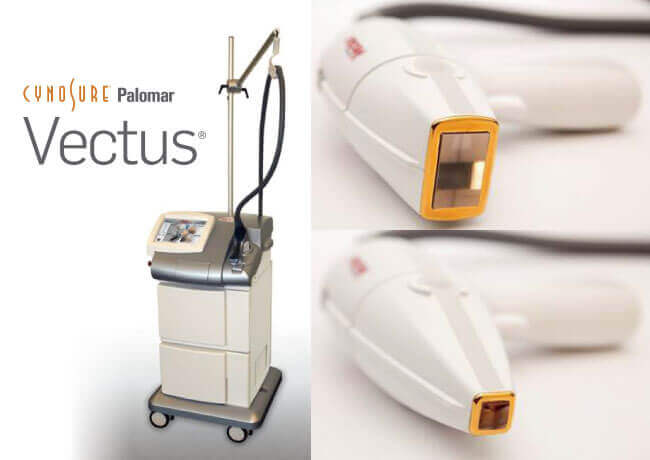 たろうメディカルクリニックで使用する医療脱毛レーザー「Vectus(ベクタス)」