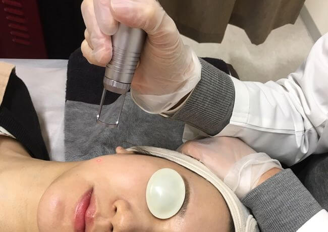 広い範囲でも均一にムラなく照射