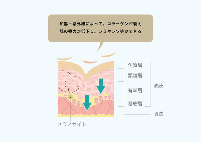 肌トラブルはなぜ起こるのか?