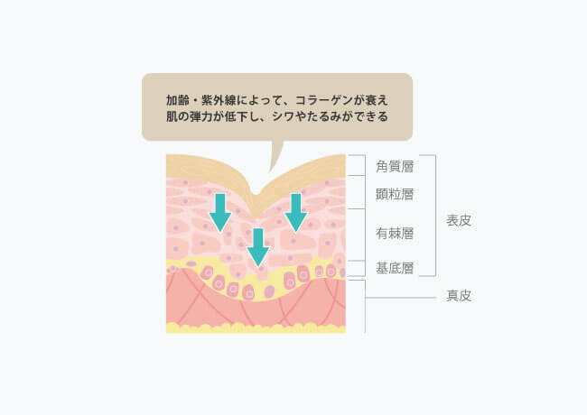 シワはなぜできるのか?