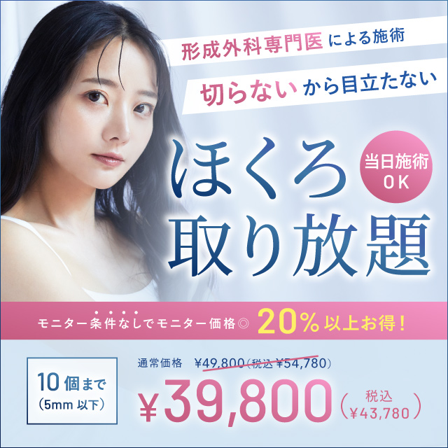 ほくろ除去キャンペーン　形成外科専門医による施術　切らないから目立たない　ほくろ取り放題　モニター条件なしでモニター価格20％オフ　49,800円（税込54,780円）→39,800円（税込43,780円）